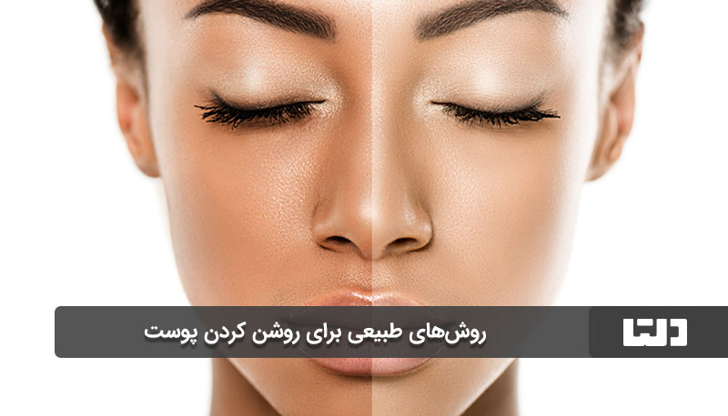 روش‌های طبیعی برای روشن کردن پوست