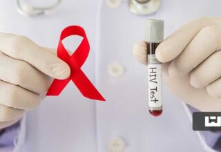 ویروس HIV