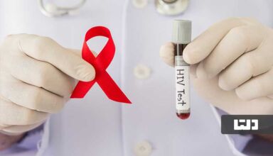 ویروس HIV