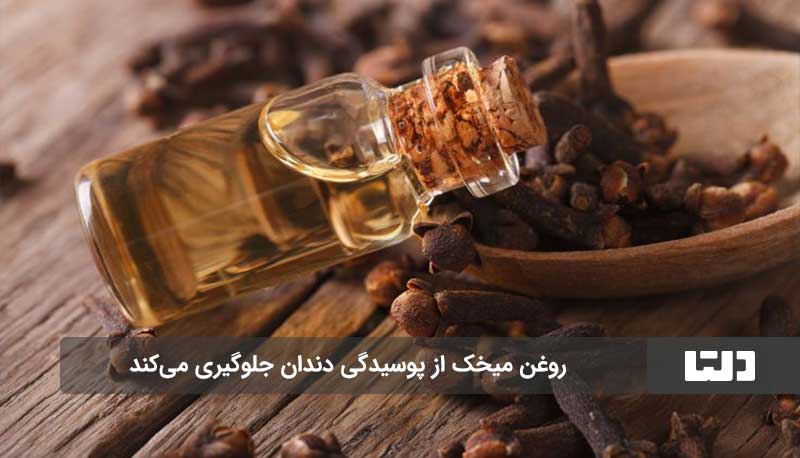 پوسیدگی دندان