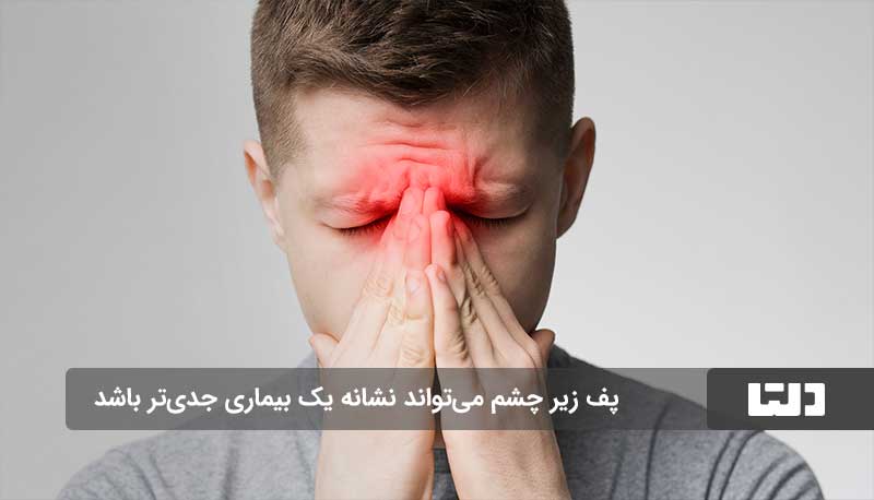 سینوزیت