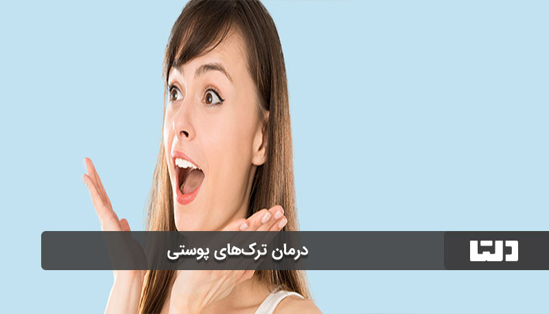 نکات مهم در استفاده از روغن نارگیل